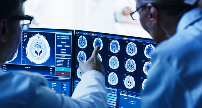 Epilepsy Diagnostic Image of Brain